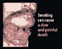 <a href='http://tioverdelo.narod.ru/elektronnye-sigarety-ubivayut.html'>электронные сигареты убивают</a>